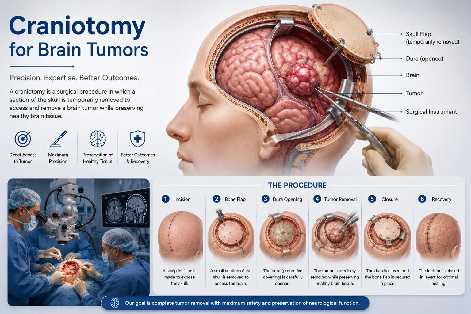 Craniotomy for Brain Tumors